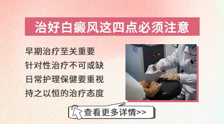 伍德灯下白癜风早期和其他白斑对比