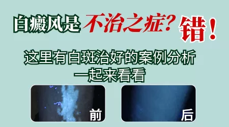 军训晒得脖子后面有白块是什么情况