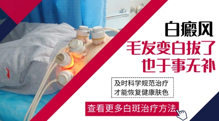 白癜风睫毛白了可以拔吗