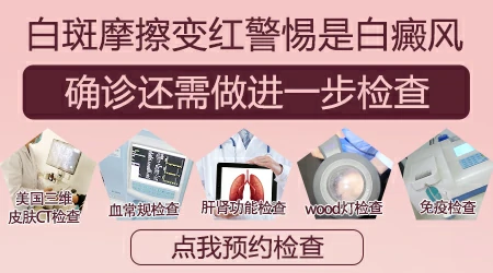 搓揉白斑局部会发红是白癜风吗