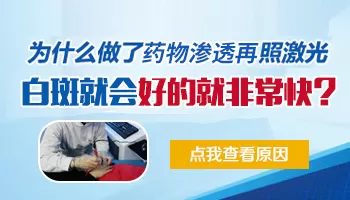 纳米促黑治疗白癜风一次多少钱