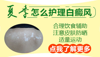 白癜风患者在夏季如何防晒