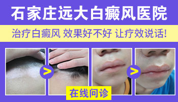 邢台的白癜风医院哪家好 邢台治白癜风的医院