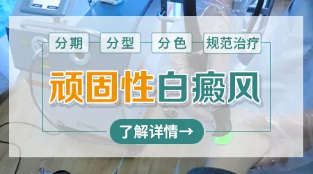 发病很久的白癜风能不能治好