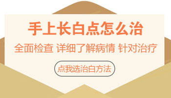 怎样治疗手上白癜风好的快 常用方法介绍
