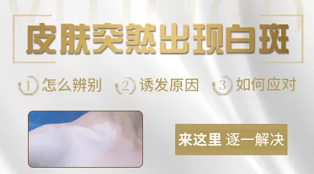 为什么皮肤会变白一块