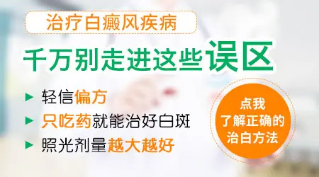 308激光如何治疗白癜风 是什么原理