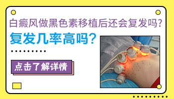 白癜风黑色素种植一次多少钱