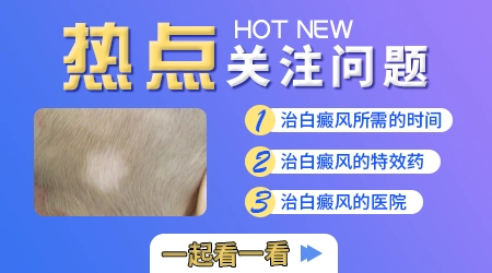 窄谱紫外线治疗白癜风和308的区别