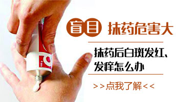 白癜风擦药后痒的厉害是什么原因