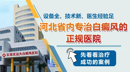 白斑是不是白癜风怎么判断 白斑好治吗