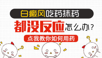 长白癜风两年多了用药能治好吗