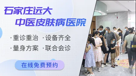 石家庄远大中医皮肤病医院好吗