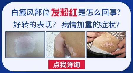 照完308后白斑部位什么表现是最有效果的