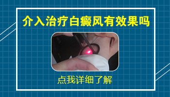 白癜风患者打介入针有副作用吗