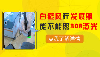 胸部周围发展期白癜风可以照光吗