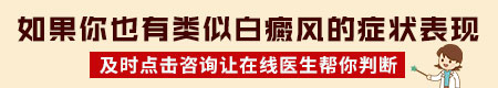 手上长白癜风的话是什么样 白癜风图片