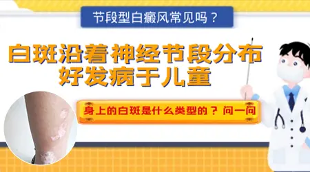 节段型白癜风会扩散到全身吗?和普通型的区别在这