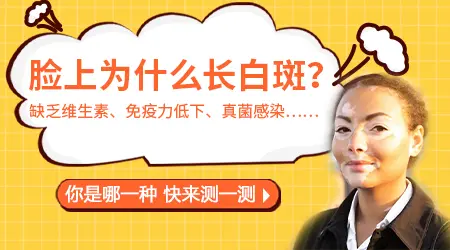 石家庄哪个医院看脸上的白斑好