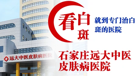 石家庄有专门的白癜风专科医院吗