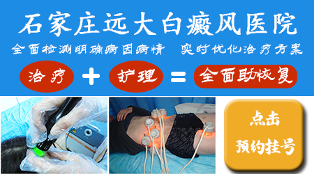 伍德灯下各种白斑图