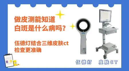 白癜风和正常皮肤白点有哪些区别