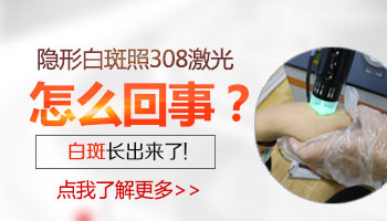 白癜风会把隐藏白的位置照出来吗