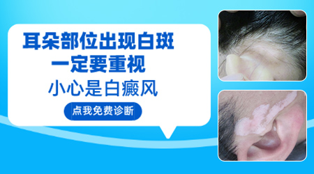 耳朵旁边白了一块还扩散是什么情况