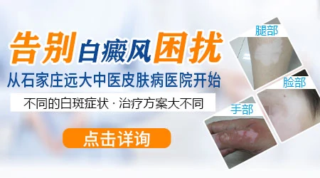 手部白癜风长什么样子