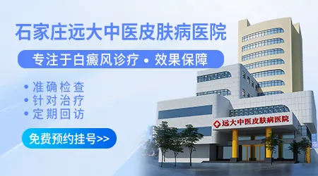 邢台有没有专门看白斑好的地方