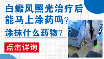 白癜风照光配合什么外用药