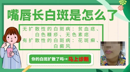 嘴唇边皮肤变白是什么原因导致的