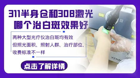 照白癜风家用光疗仪308好还是311好