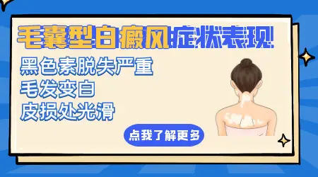 毛囊型白癜风的睫毛越来越白