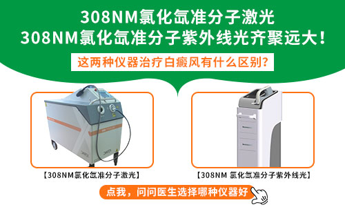 紫外线308光疗后白癜风多久能恢复
