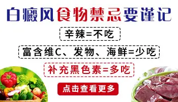 食疗能治好白癜风吗 白癜风不能吃什么