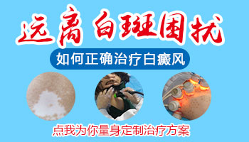 脖子和胸部长白斑如何治疗效果好