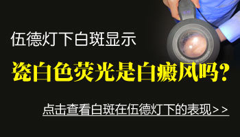 白癜风变成瓷白色了还能治好吗
