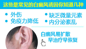 白癜风脸部早期图片有哪些