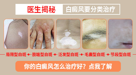 背上手上有一小片白斑是什么类型的白斑