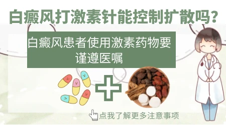 孩子白斑扩散快怎么办 进展期控制方案