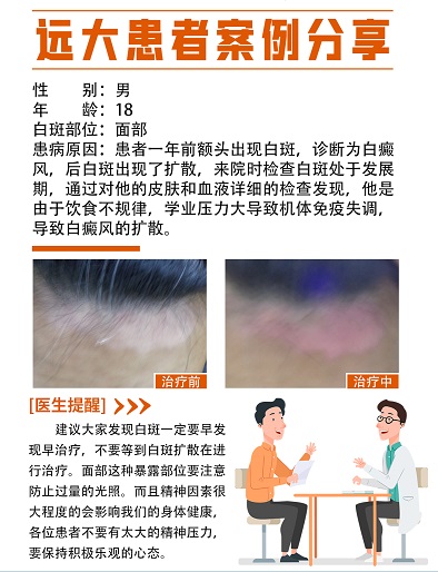 白癜风稳定期可以打疫苗吗