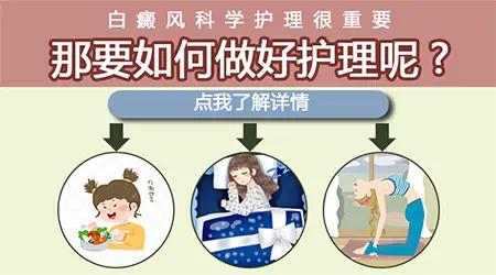 白癜风治疗期间可以正常化妆遮盖白斑吗