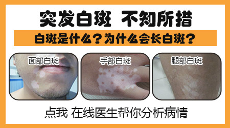 什么样的白斑不用治 各种白斑图片对比