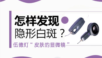白癜风的隐形白斑症状是什么样