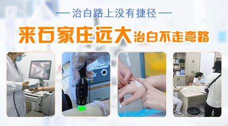河北石家庄周边哪个医院治疗白癜风有名