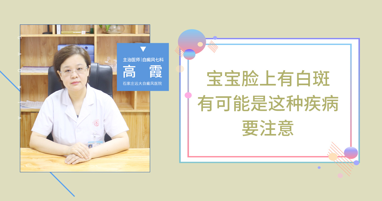 宝宝脸上有白斑可能是这种疾病要注意