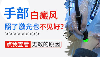 手上白癜风光疗不起作用