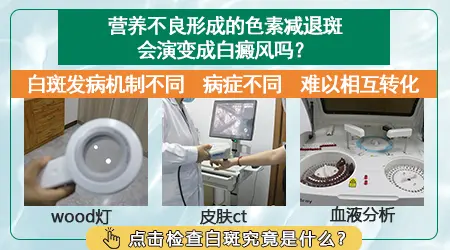 营养不良会不会导致脸上长白斑