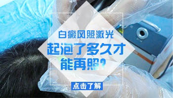 手指白癜风照光起泡好的快吗